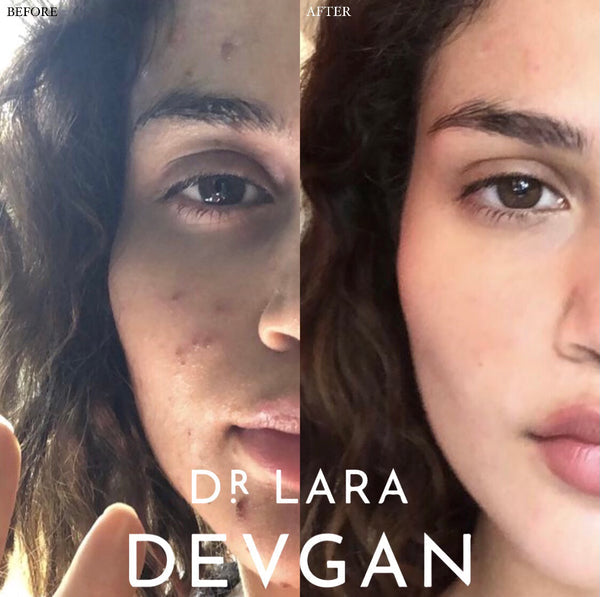 Dr. Lara Devgan Retinol + Bakuchiol Serum 2.5x