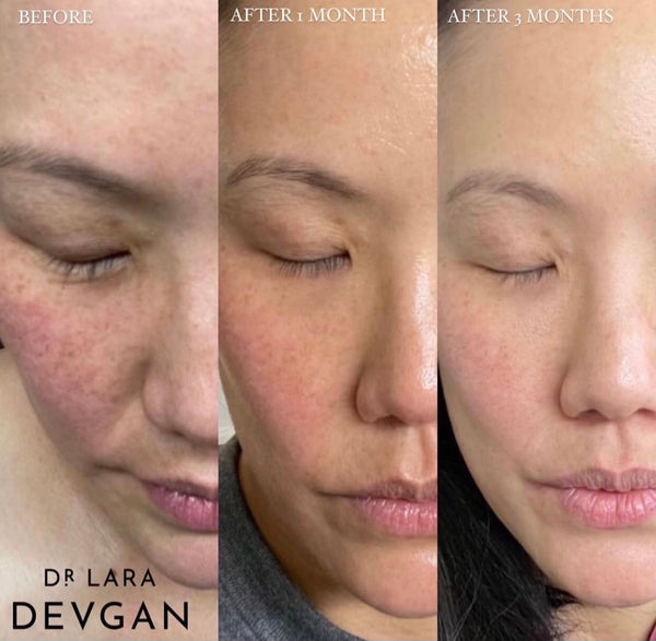 Dr. Lara Devgan Vitamin C+B+E Ferulic Serum